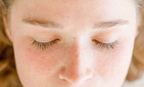 Trockene Augen: Diese 4 Hausmittel helfen