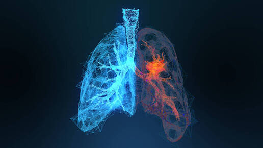 Neue Krebsimmuntherapie bei Lungenkrebs in Sicht